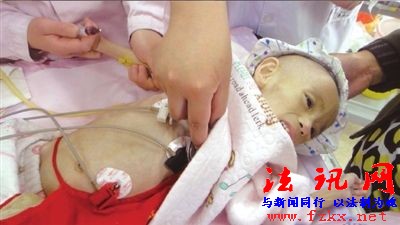 “骷髅女孩”小雨鑫赴京求医 李春平捐款15万(图) “骷髅女孩”小雨鑫赴京求医 李春平捐款15万(图)